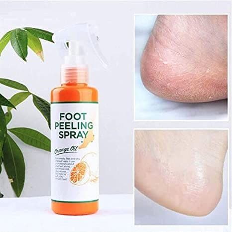  اسپری ترک و خشکی پا foot peeling spray 
